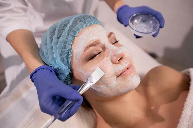 Peeling Químico